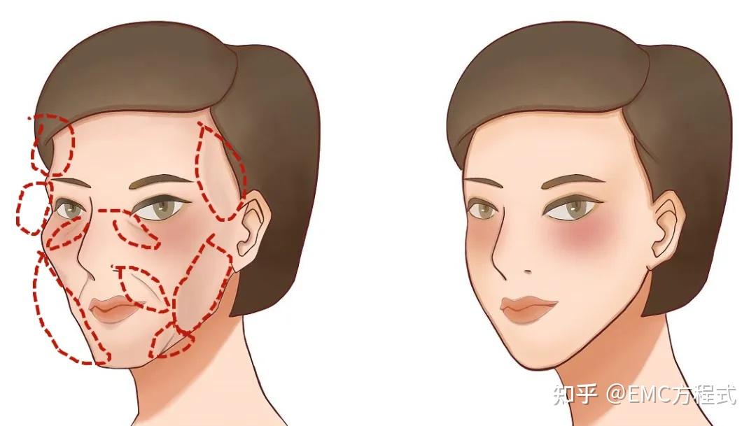 全球首款液态PCL GOURI格奥润 提升线雕 第四代少女 激活胶原新生(图8) 全球首款液态PCL GOURI格奥润 提升线雕 第四代少女 激活胶原新生(图8)